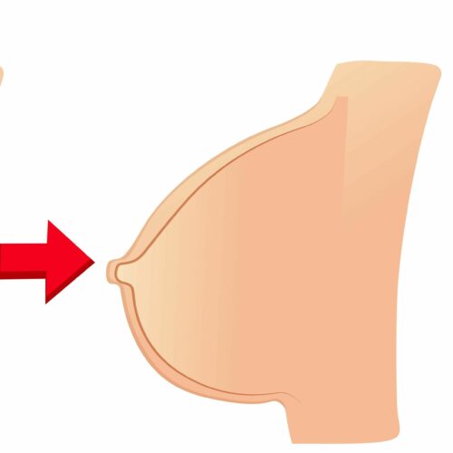 Προετοιμασία του στήθους για το θηλασμό