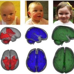 Ο εγκέφαλος των παιδιών που θηλάζουν παρουσιάζει πρώιμη ανάπτυξη